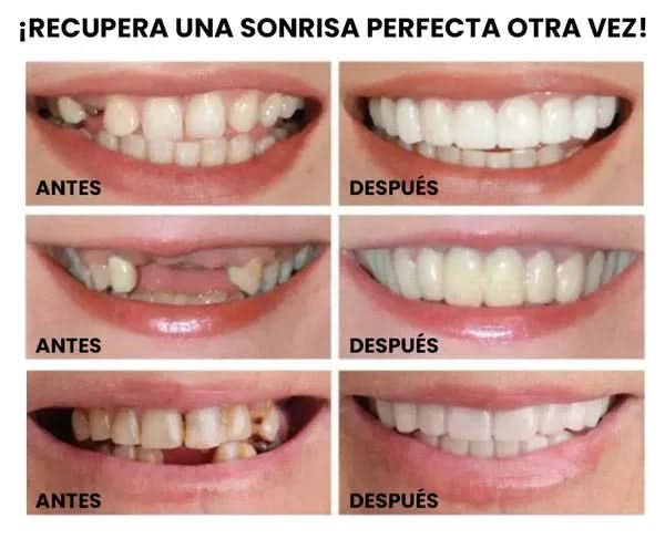 Sonrisa Perfecta Instantánea