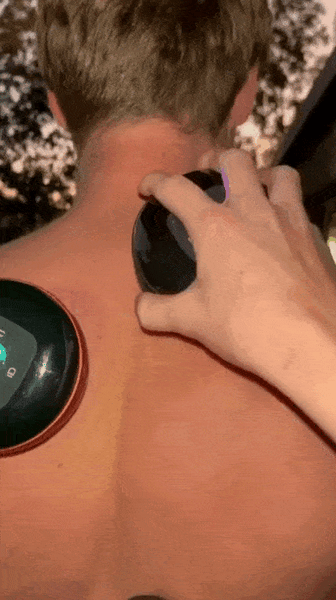 Máquina de Ventosas 4 en 1 - Masajeador Inteligente con Calor, Luz Roja y Succión Ajustable