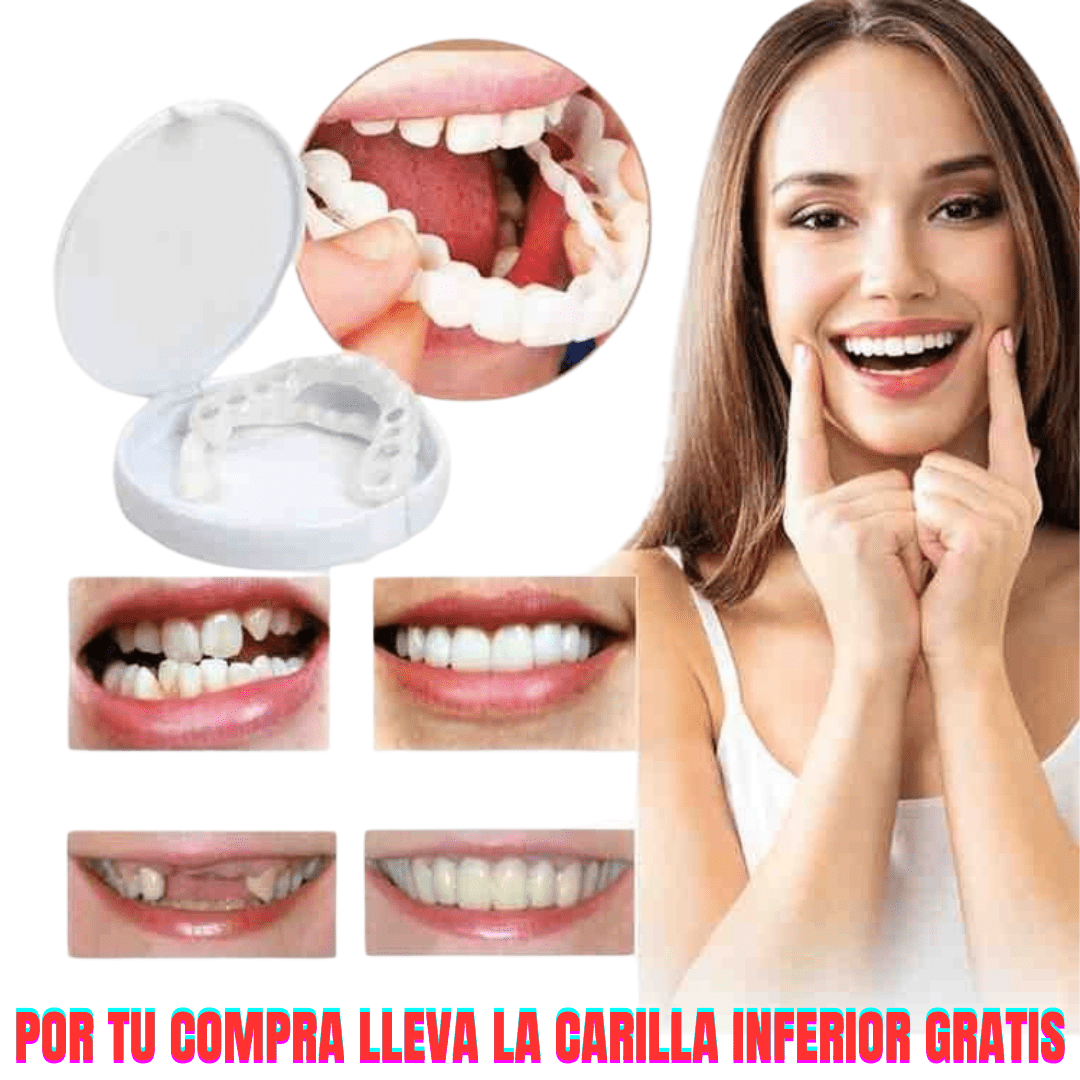 Carillas Dentales Instantáneas – Sonrisa Perfecta en Segundos - Amya Chile