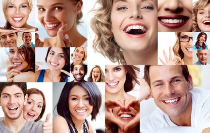 Carillas Dentales Instantáneas – Sonrisa Perfecta en Segundos - Amya Chile