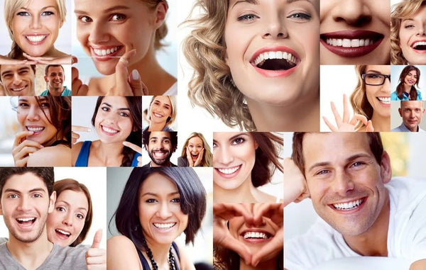 Carillas Dentales Instantáneas – Sonrisa Perfecta en Segundos - Amya Chile