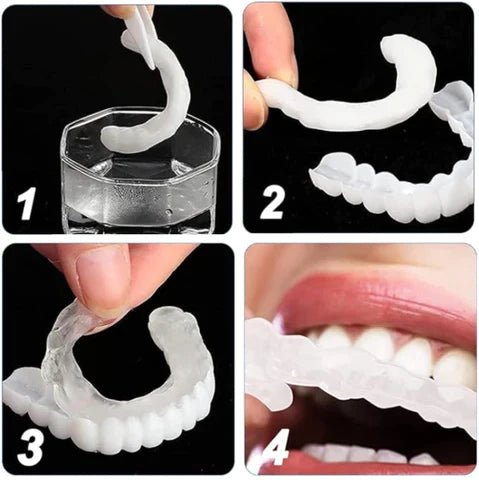 Carillas Dentales Instantáneas – Sonrisa Perfecta en Segundos - Amya Chile